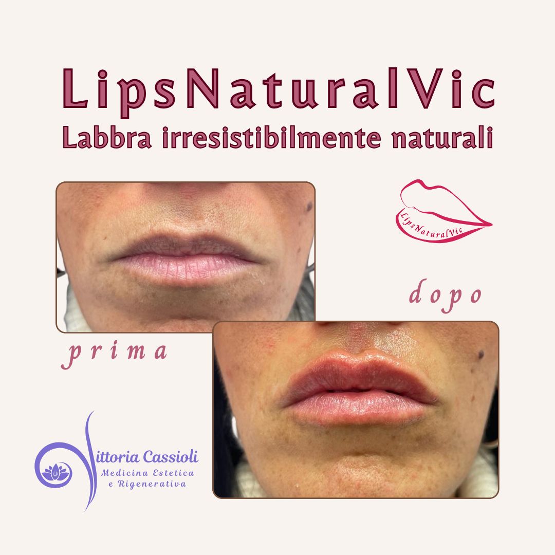 Vittoria Cassioli-42