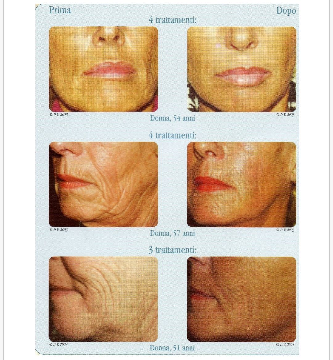 Alessandro Tamburini-1