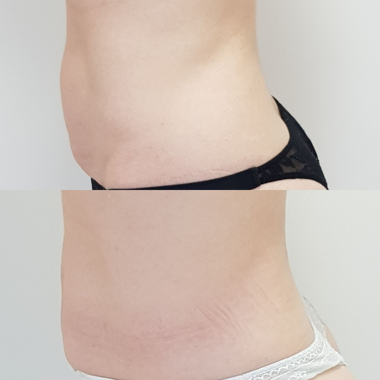 Rosalba Herrero Zerpa-292