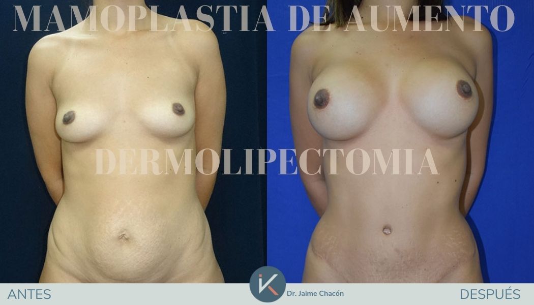 Jaime Eduardo Chacón Hernández-8