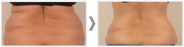 Anita Orzechowska-12