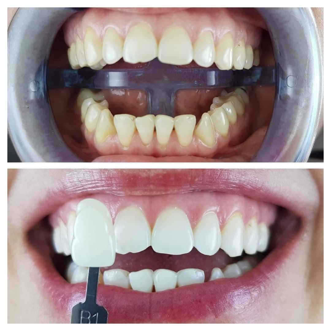 Justyna Wasińska-18