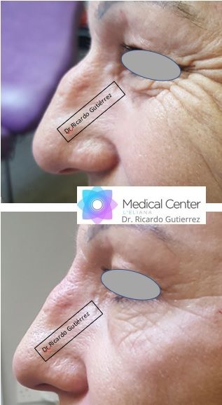 Ricardo Gutierrez Fayos-2