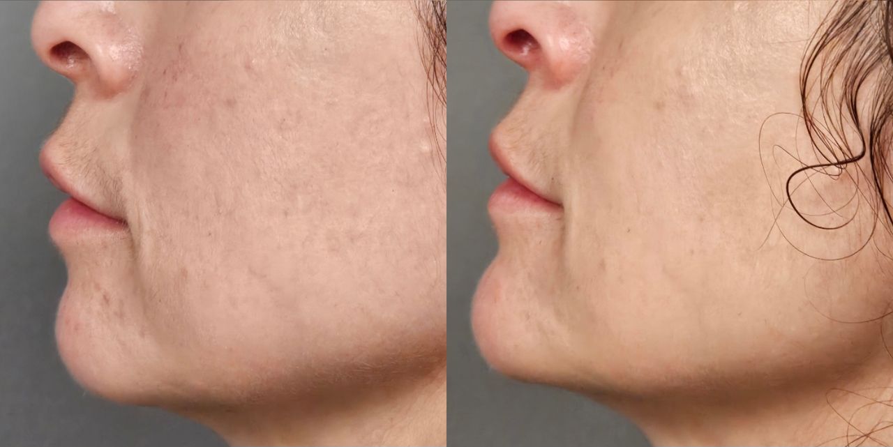 Rosalba Herrero Zerpa-529