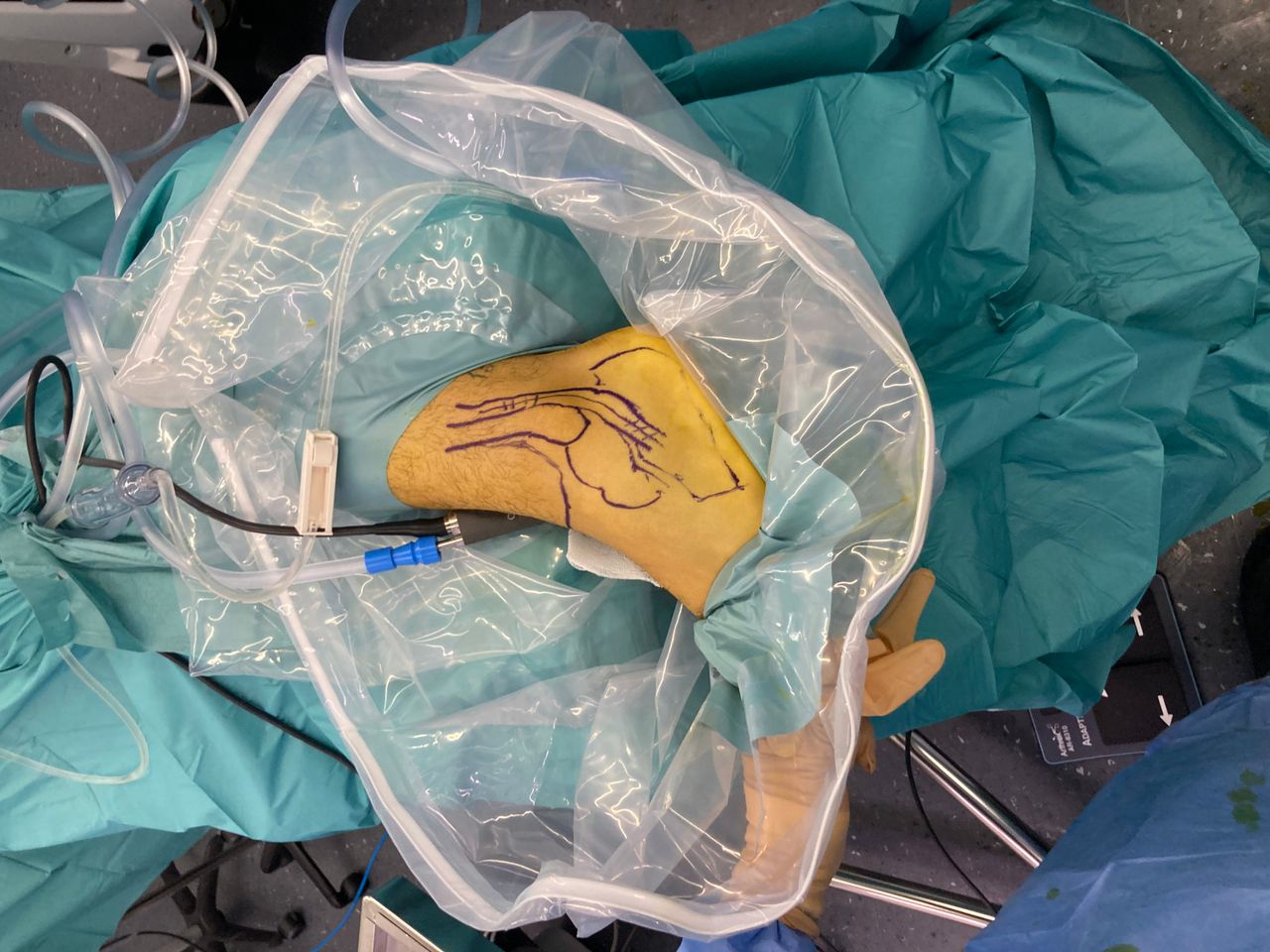 Ernesto Galán Fernández-4