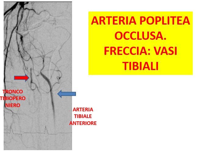 Gianni De Angelis-13