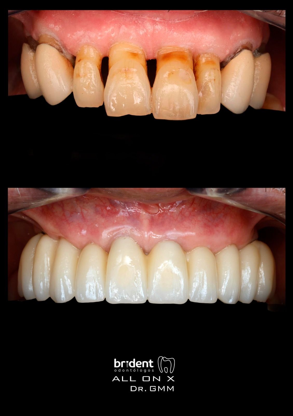 Guillermo Moreno Masiá-70