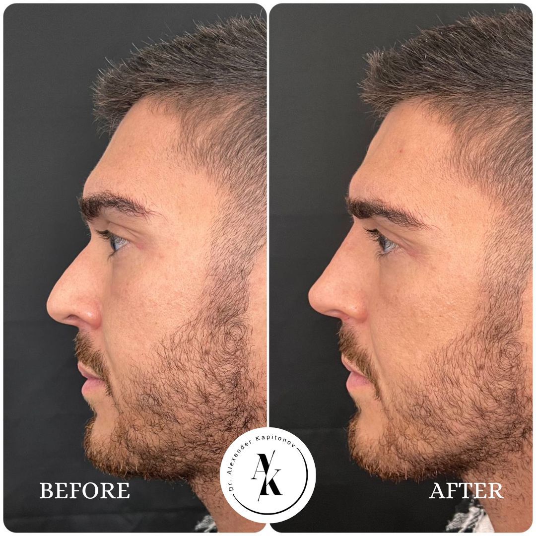 Alexandr Kapitonov-4