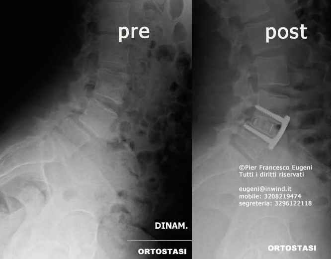 Pier Francesco Eugeni-9