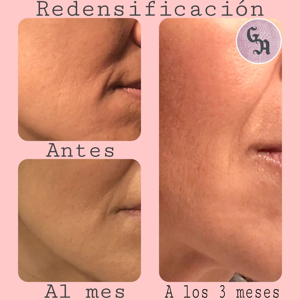 Gracia Alonso Rosales-8