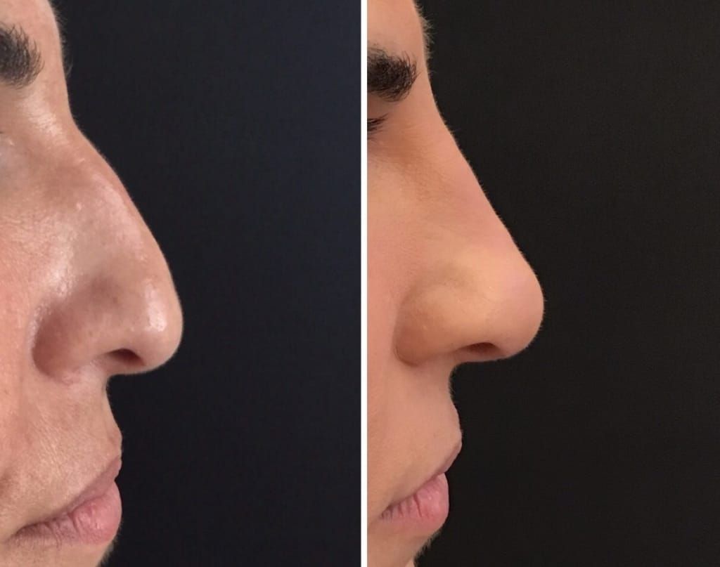 Lorella Di Battista-5