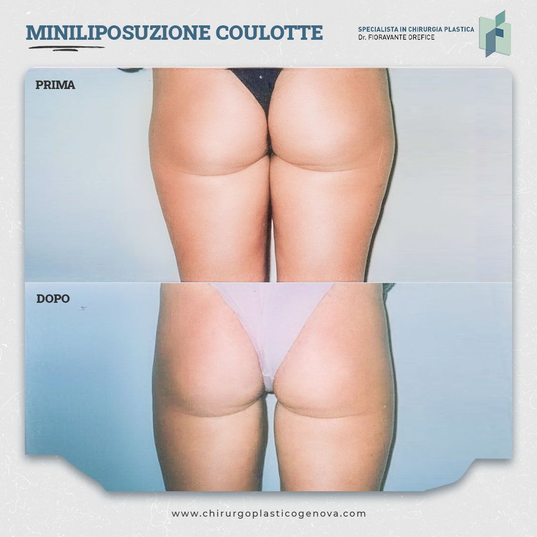 Fioravante Orefice-15