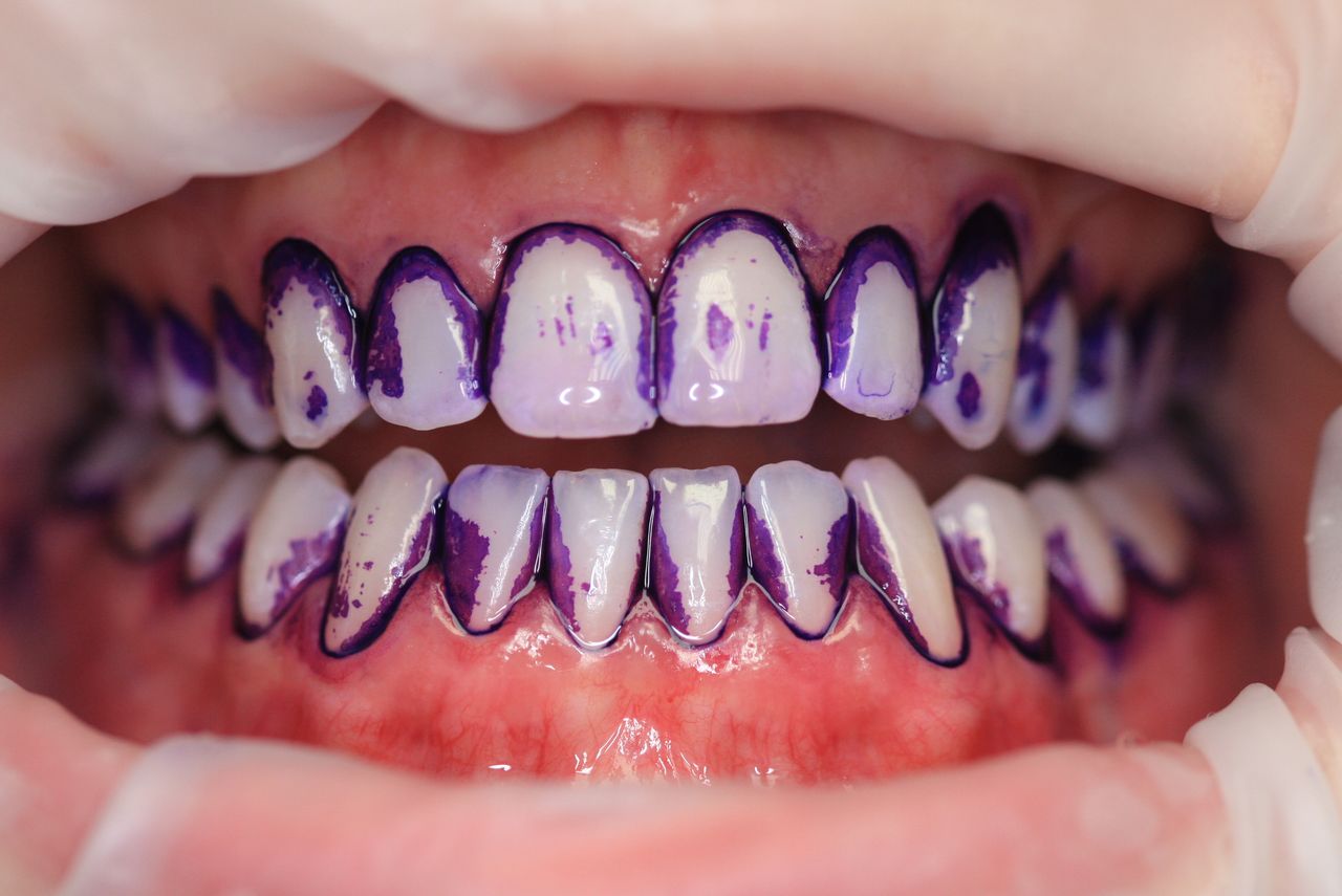 Paulina Sawicka-Soszyńska-26