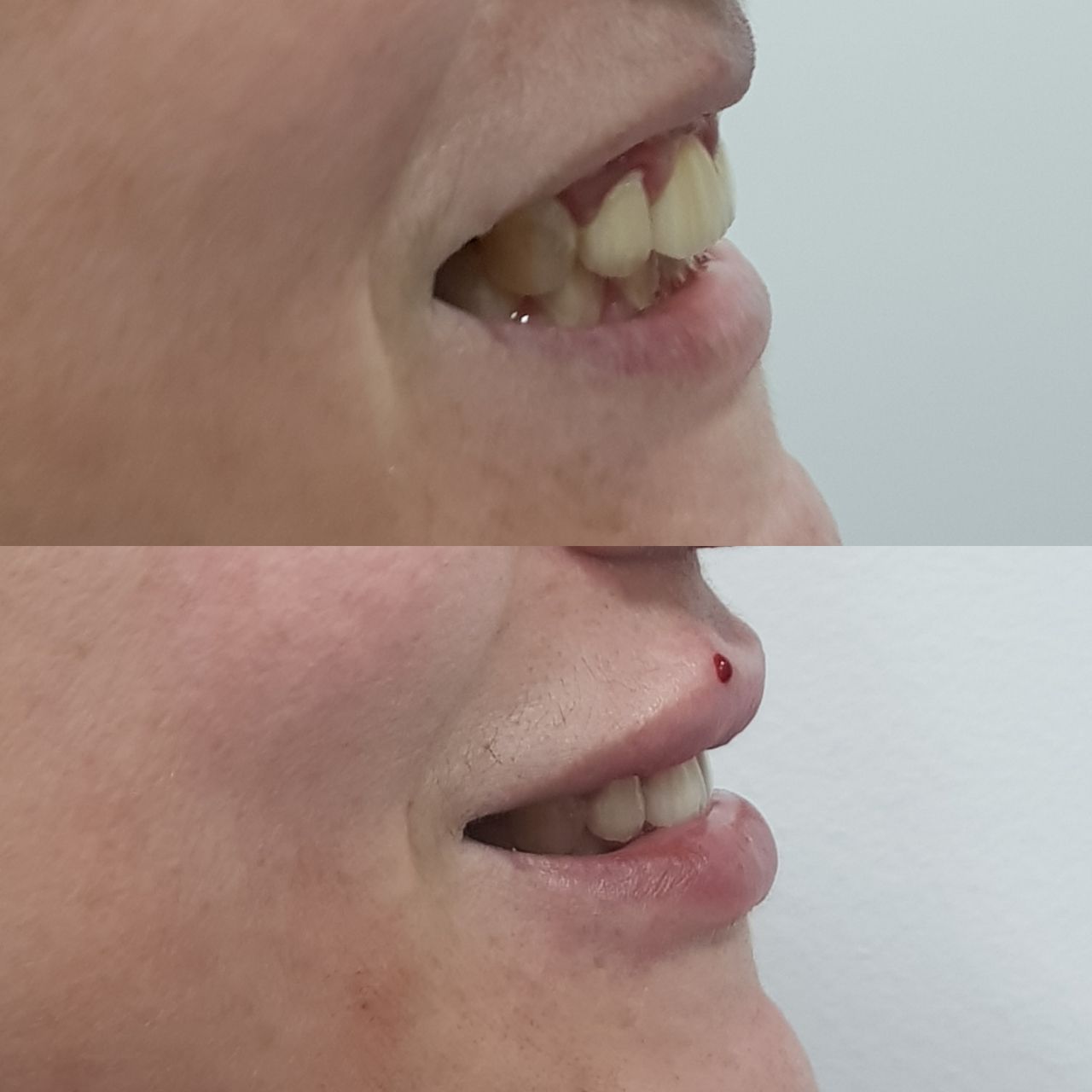 Rosalba Herrero Zerpa-237