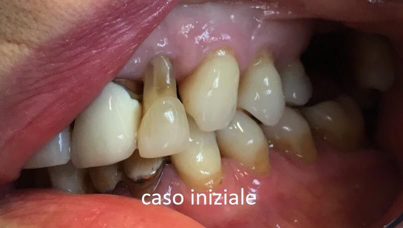 Michelina Borrelli-16