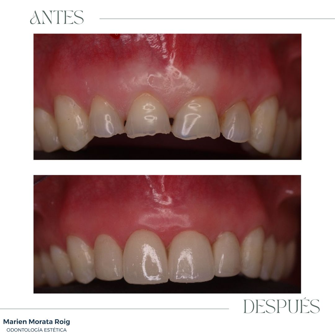 Marien Morata Roig-14