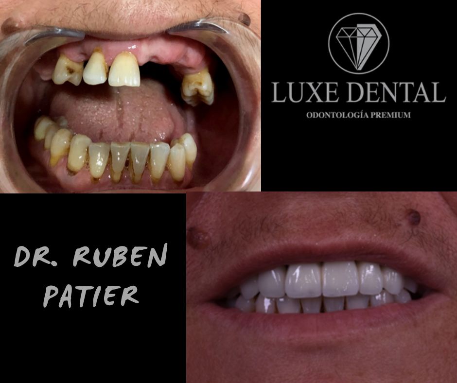 Ruben Patier Martin-26