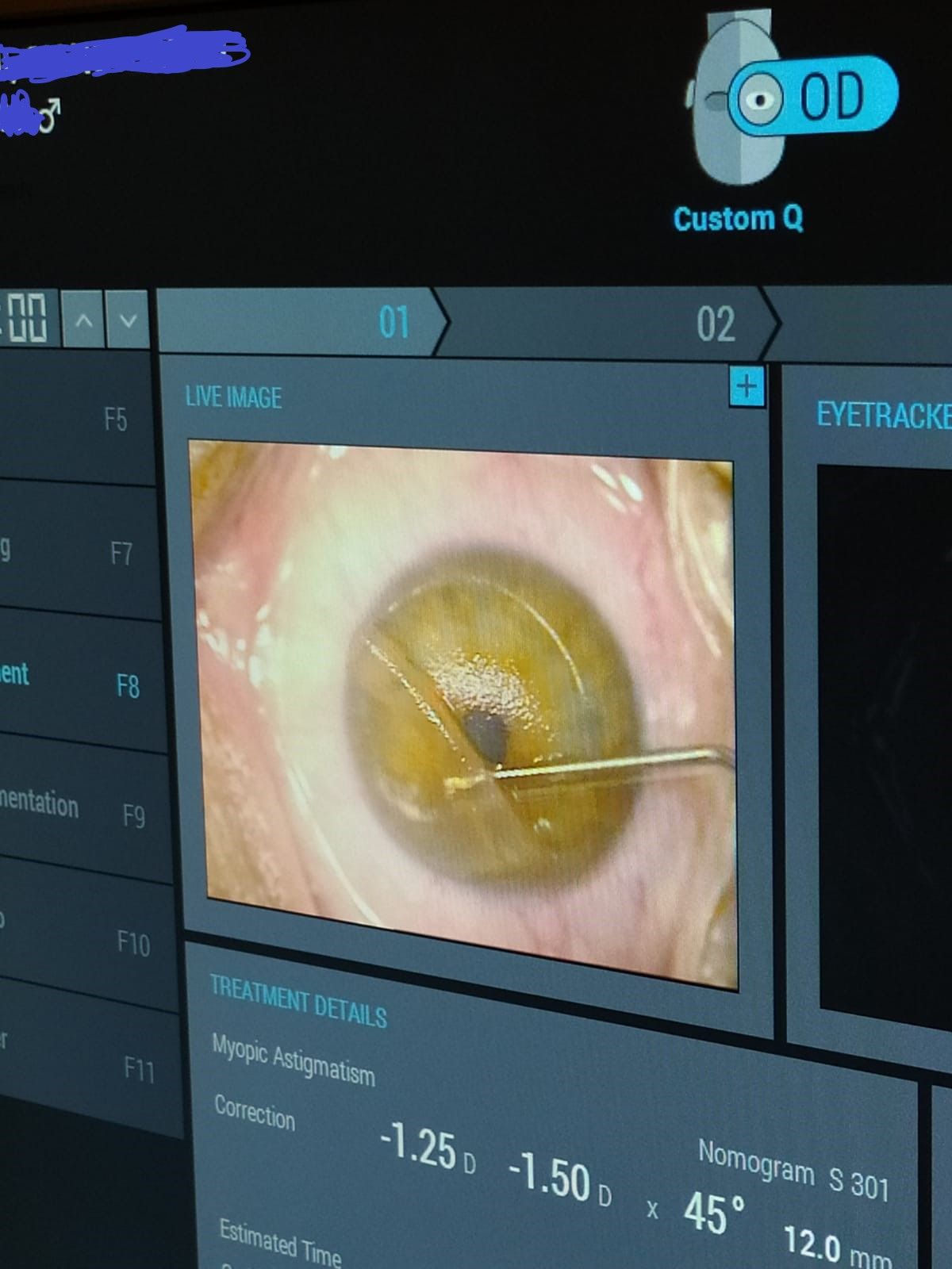 Piero Della Giustina-3