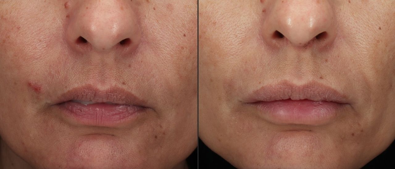 Giordano Vespasiani-20