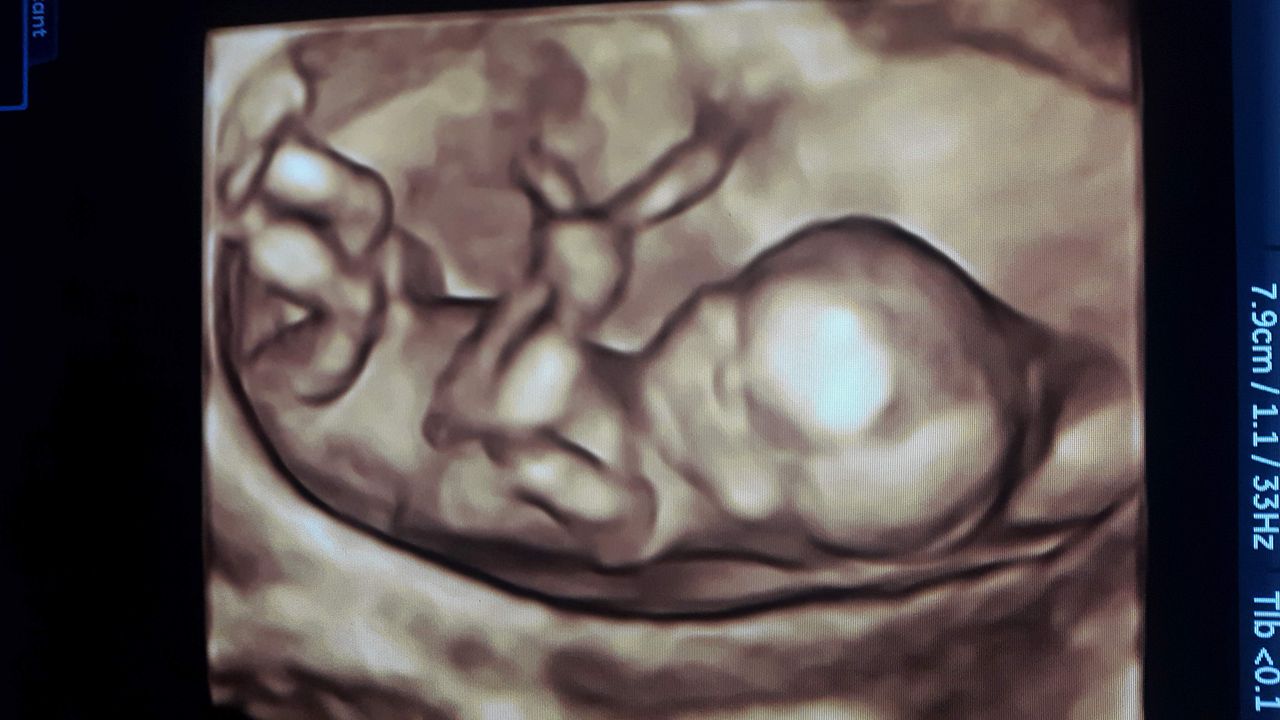 Jakub Doruchowski-12