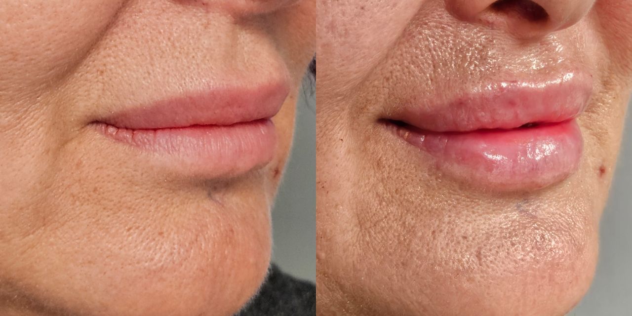 Rosalba Herrero Zerpa-580