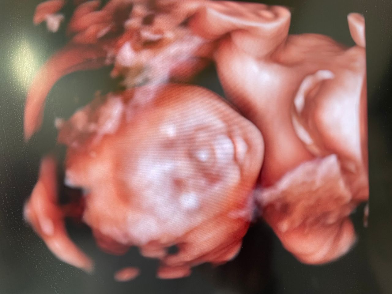 D'ambrosi Francesco-0