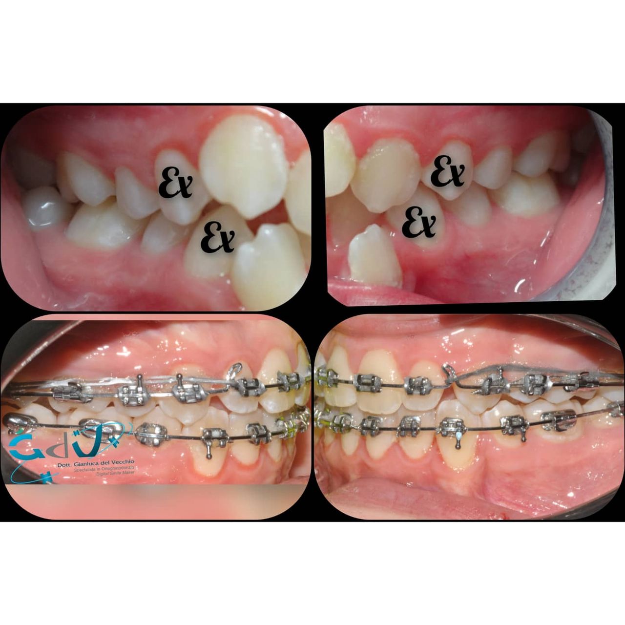 Gianluca Del Vecchio-126