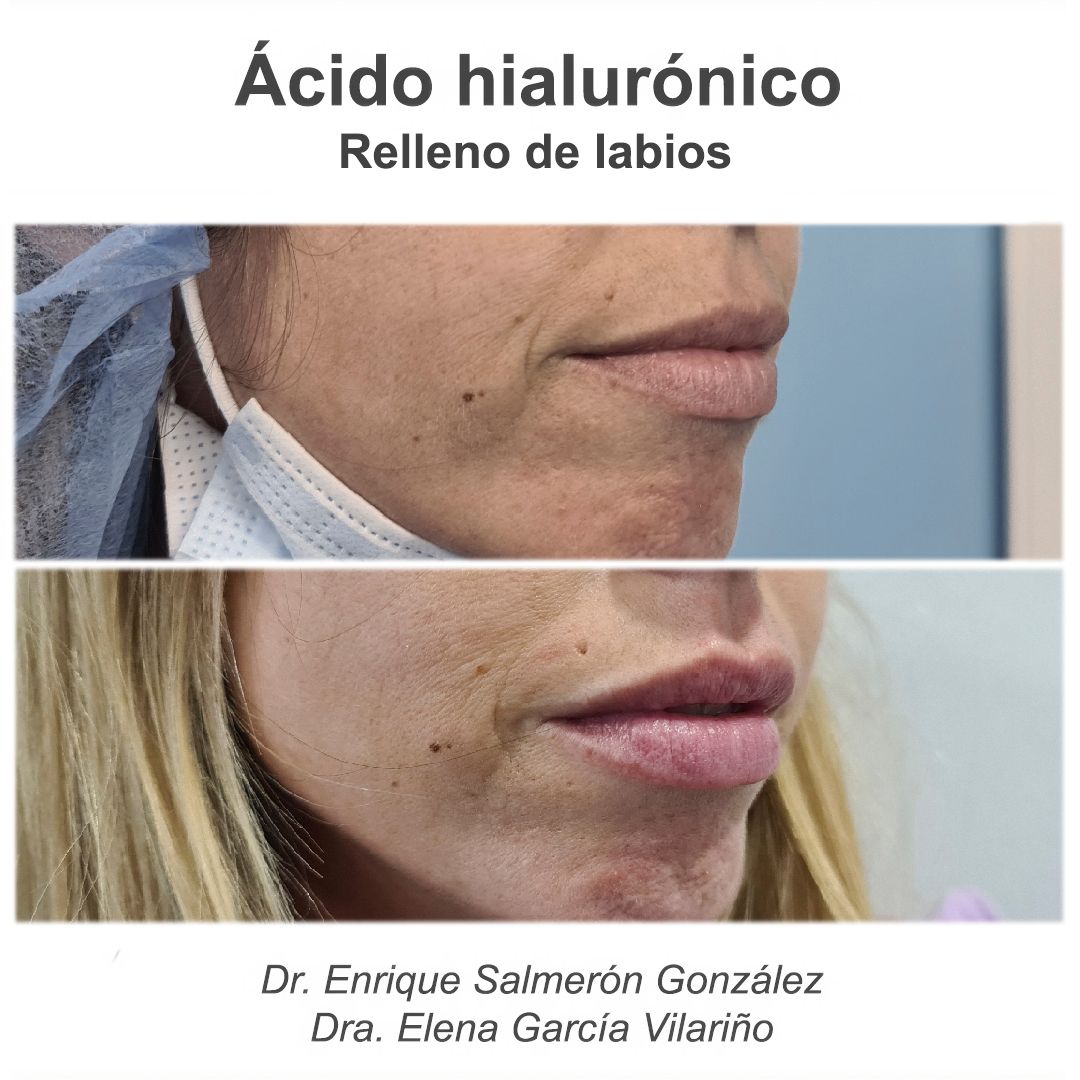 Enrique Salmerón González-78