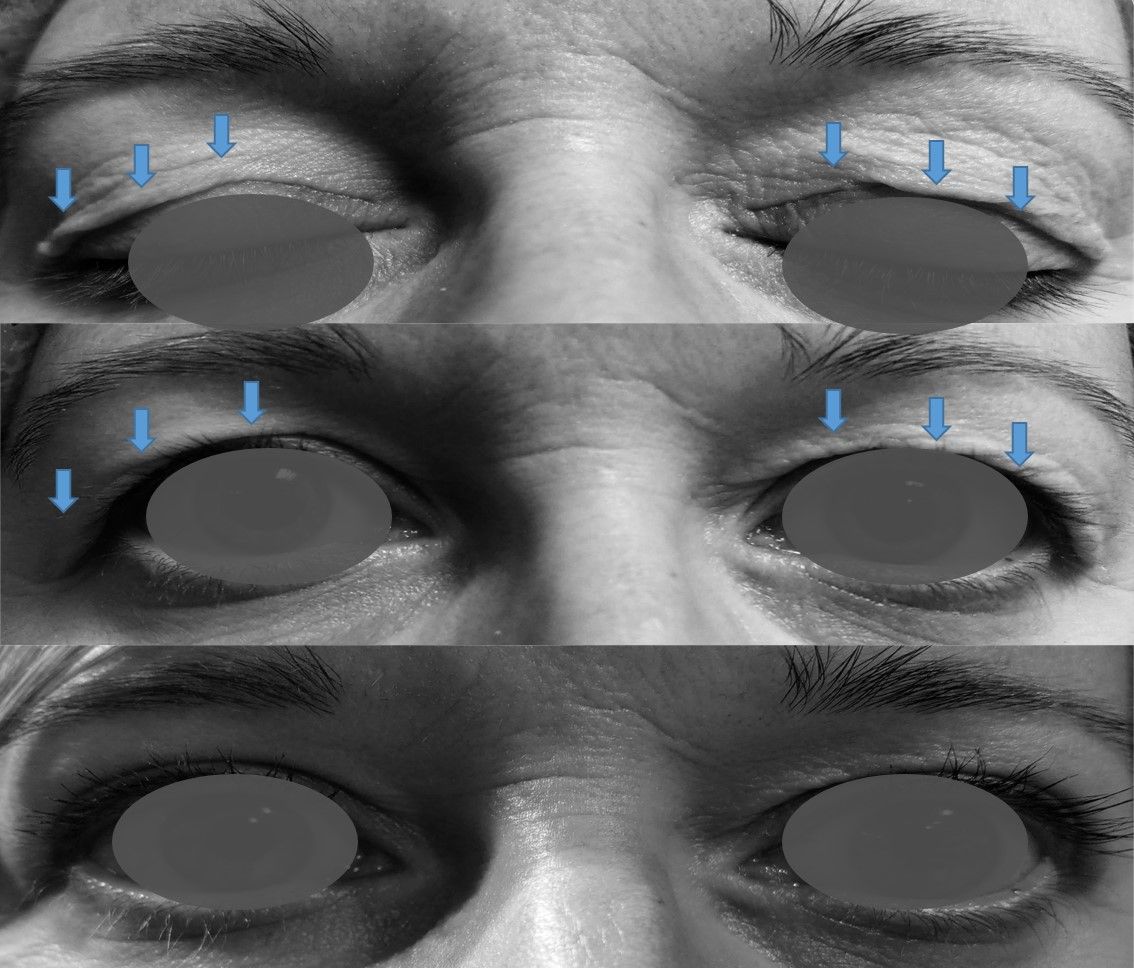 Telmo Xabier Lertxundi Plaza-10