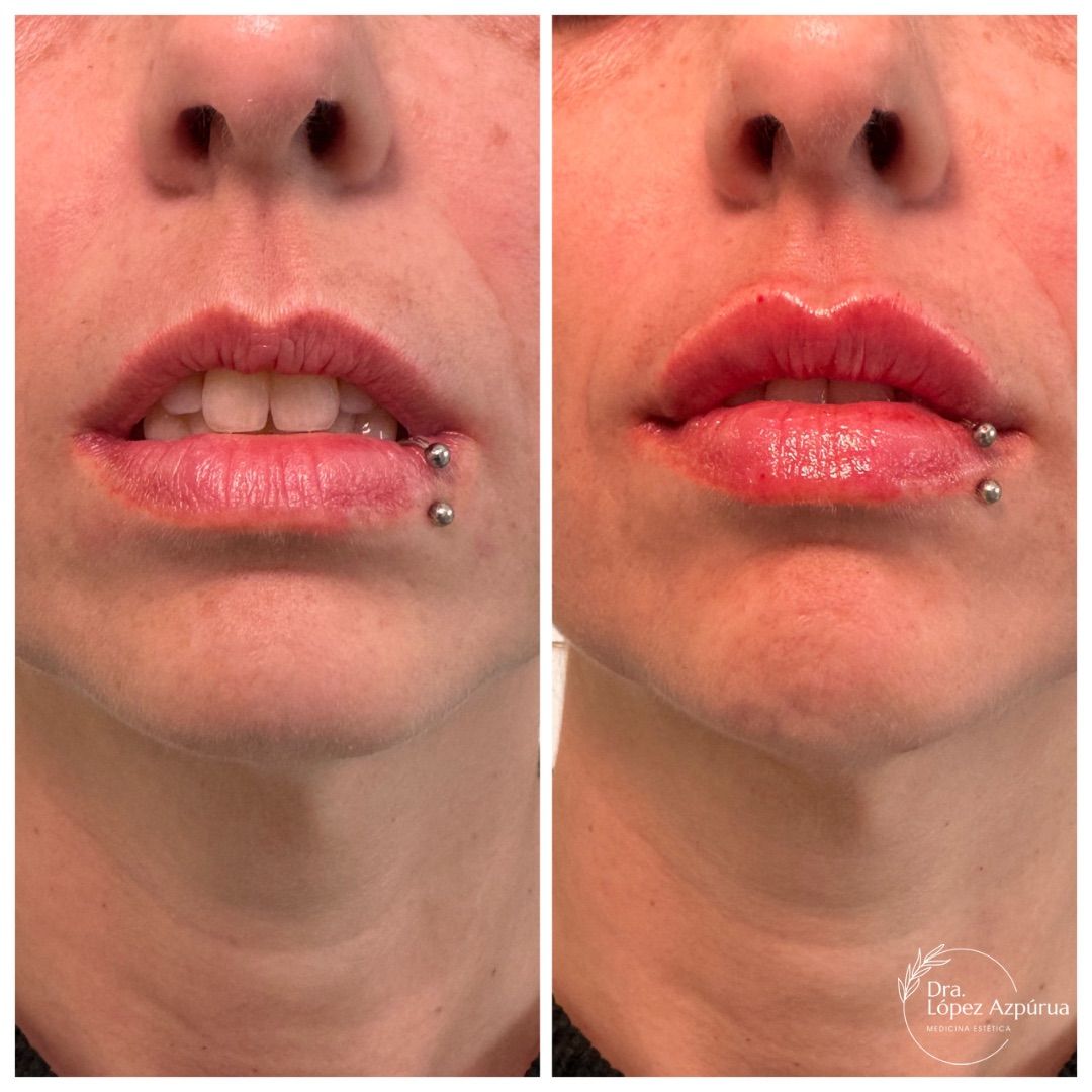 Alexandra López Azpúrua-4