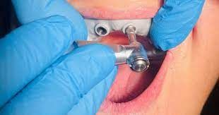 Paolo Bastianelli-24