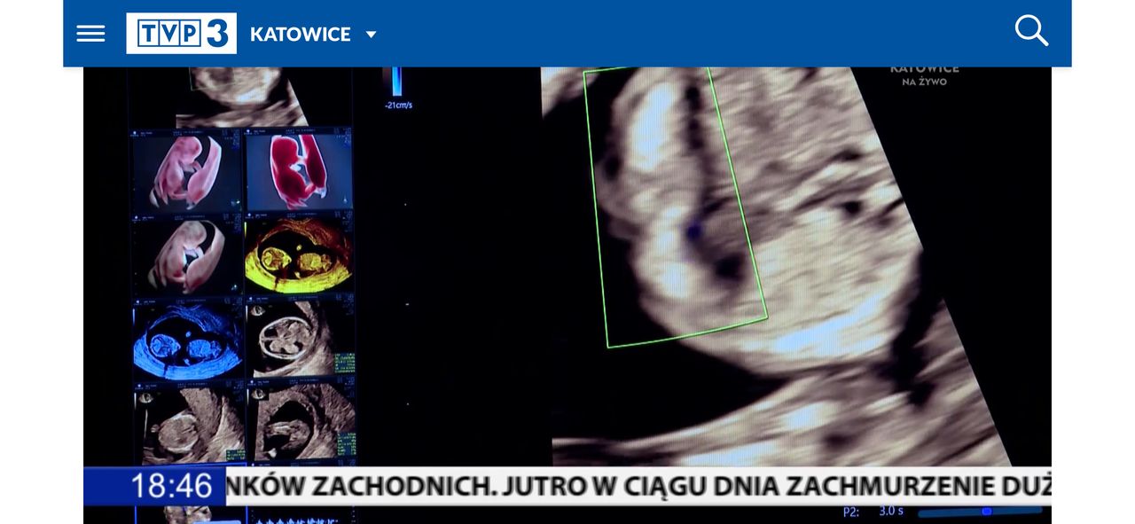 Wioletta Rozmus-Warcholińska-97