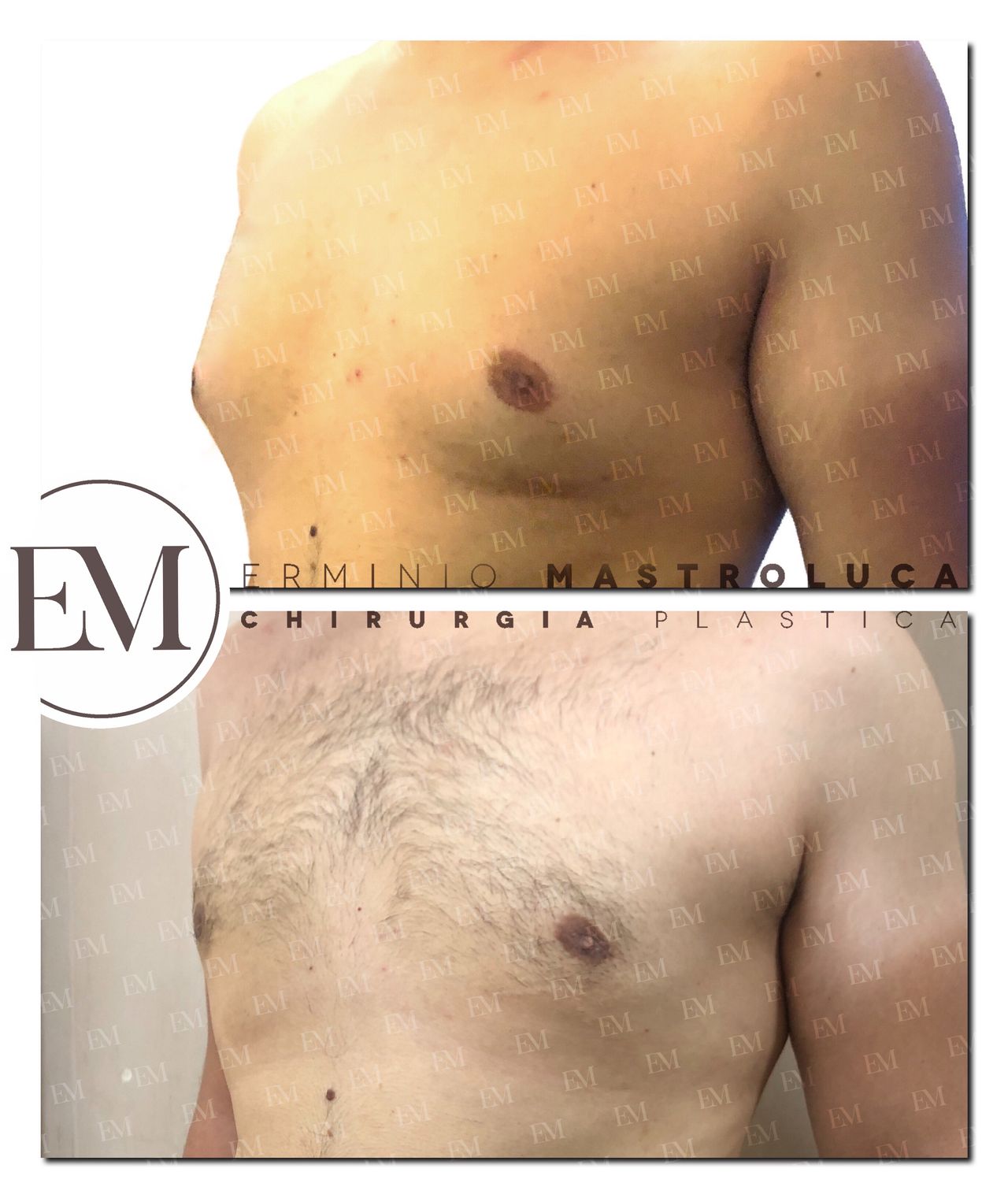 Erminio Mastroluca-3