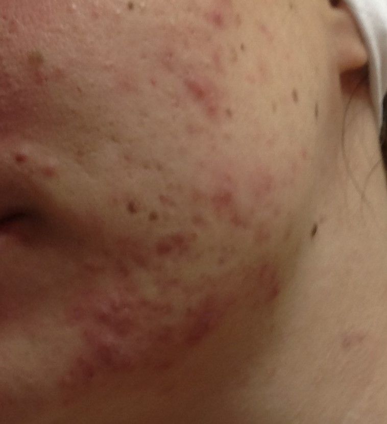 Rosario Antonio Labianca-9