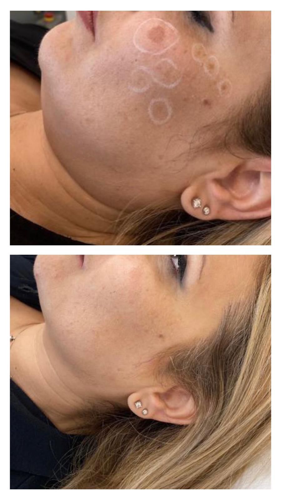 Michele Picciallo-24