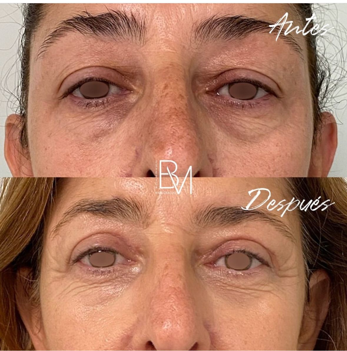 Beatriz Moralejo-59
