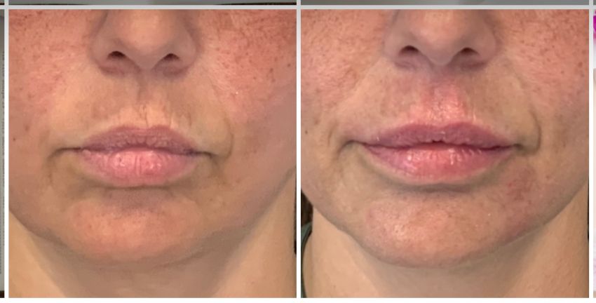 Silvia Melania Baio-12