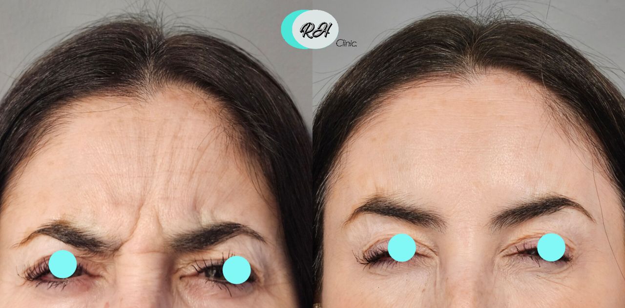 Rosalba Herrero Zerpa-604