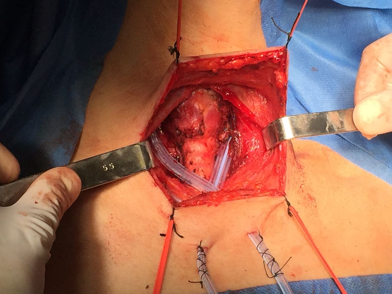 Massimiliano Boccuzzi-0