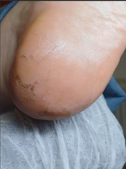 Halyna Strykharchuk -5