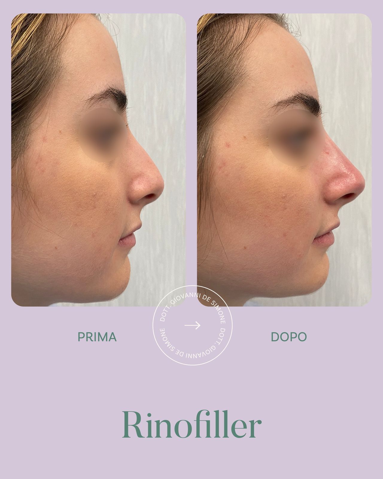 Giovanni De Simone-0