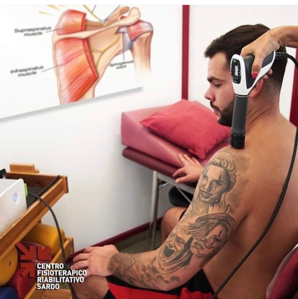 Onde D'urto Radiali Cfrs-0