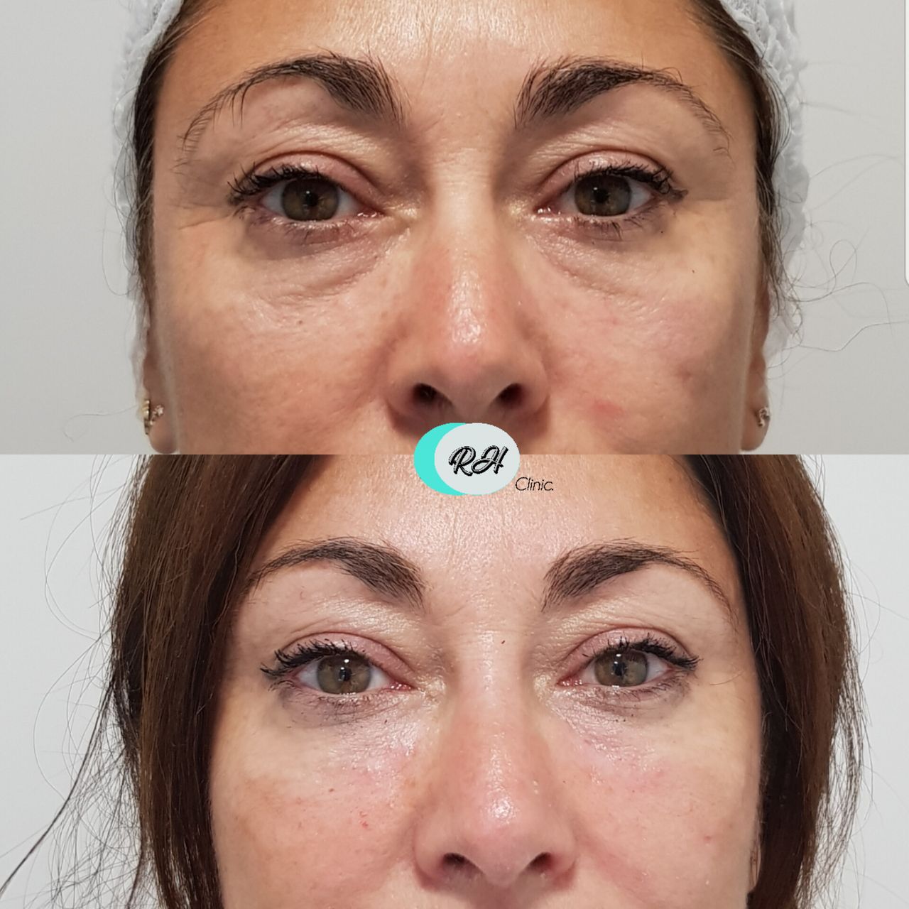 Rosalba Herrero Zerpa-603