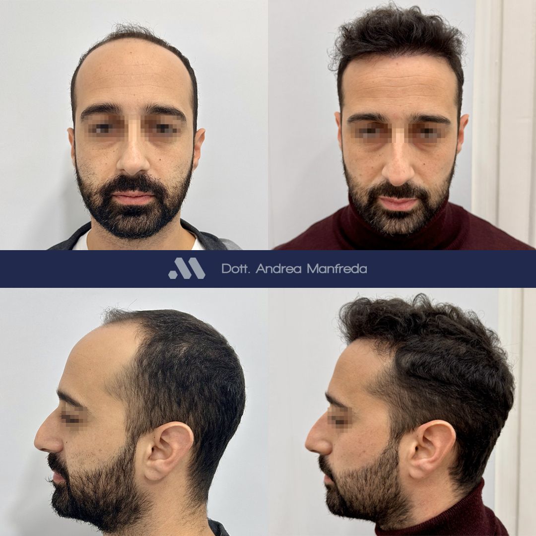 Andrea Manfreda-36