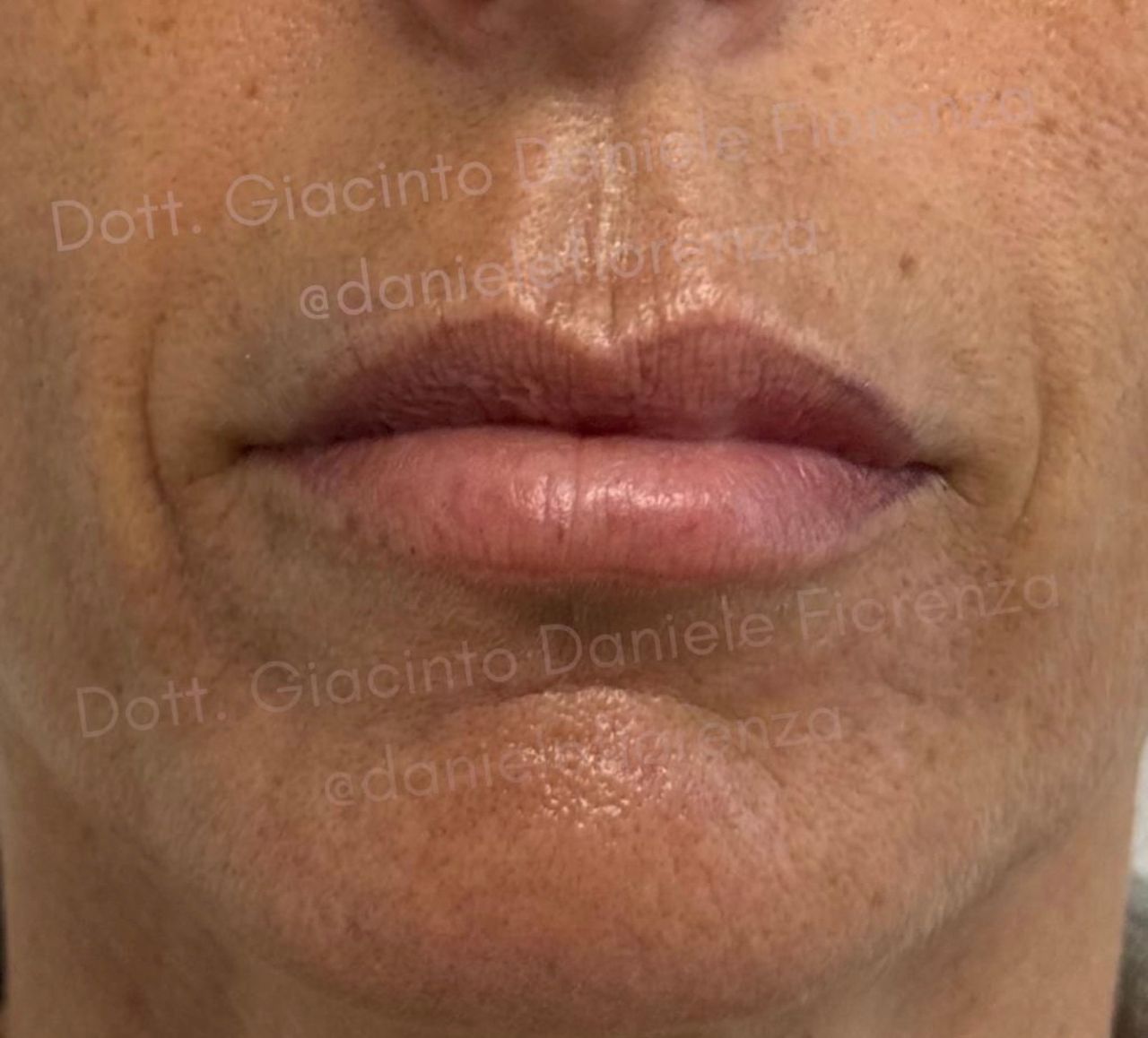 Giacinto Daniele Fiorenza-2