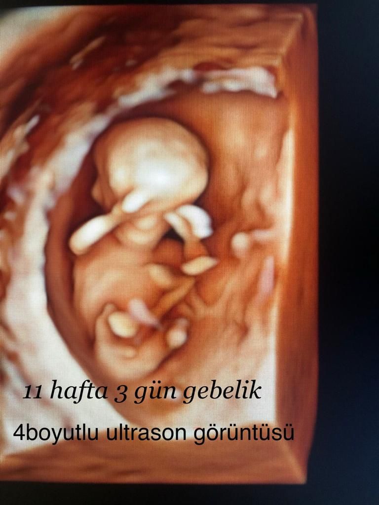 Dilek Turğut Kestane-8