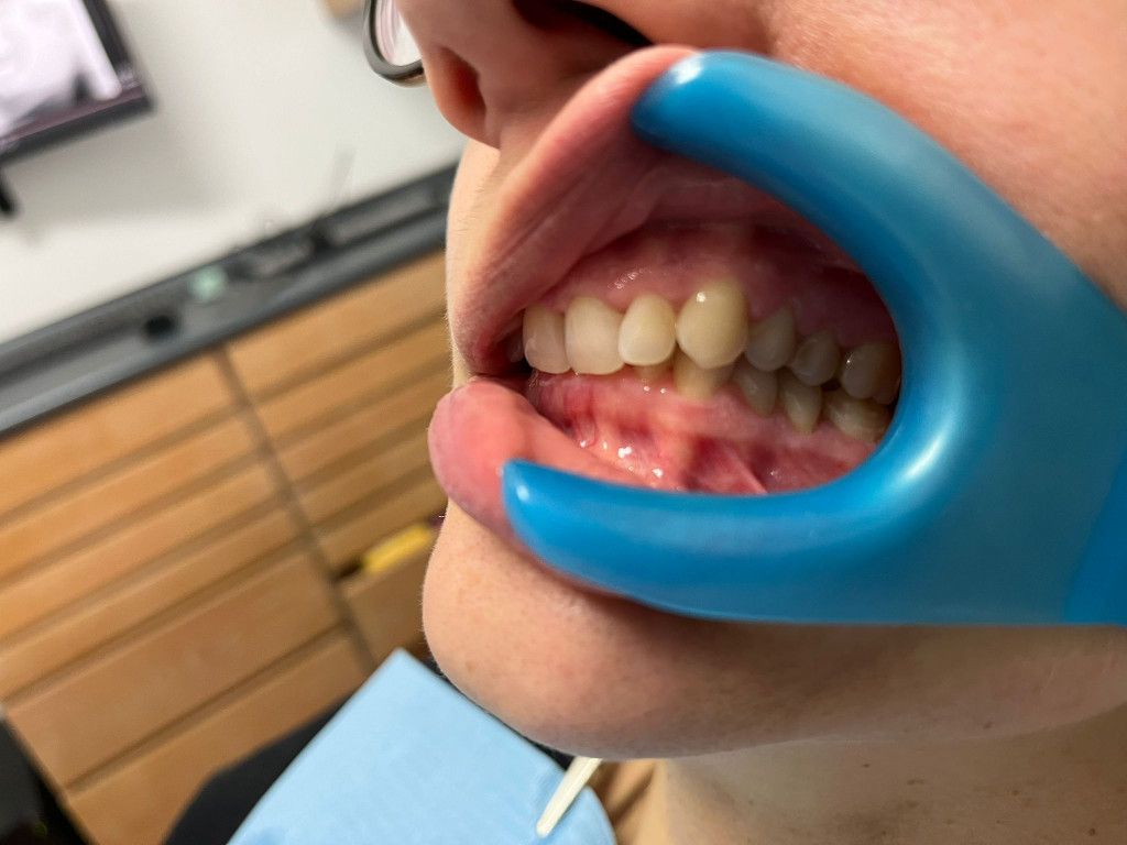 Riunito Dentista Dentalpar-11