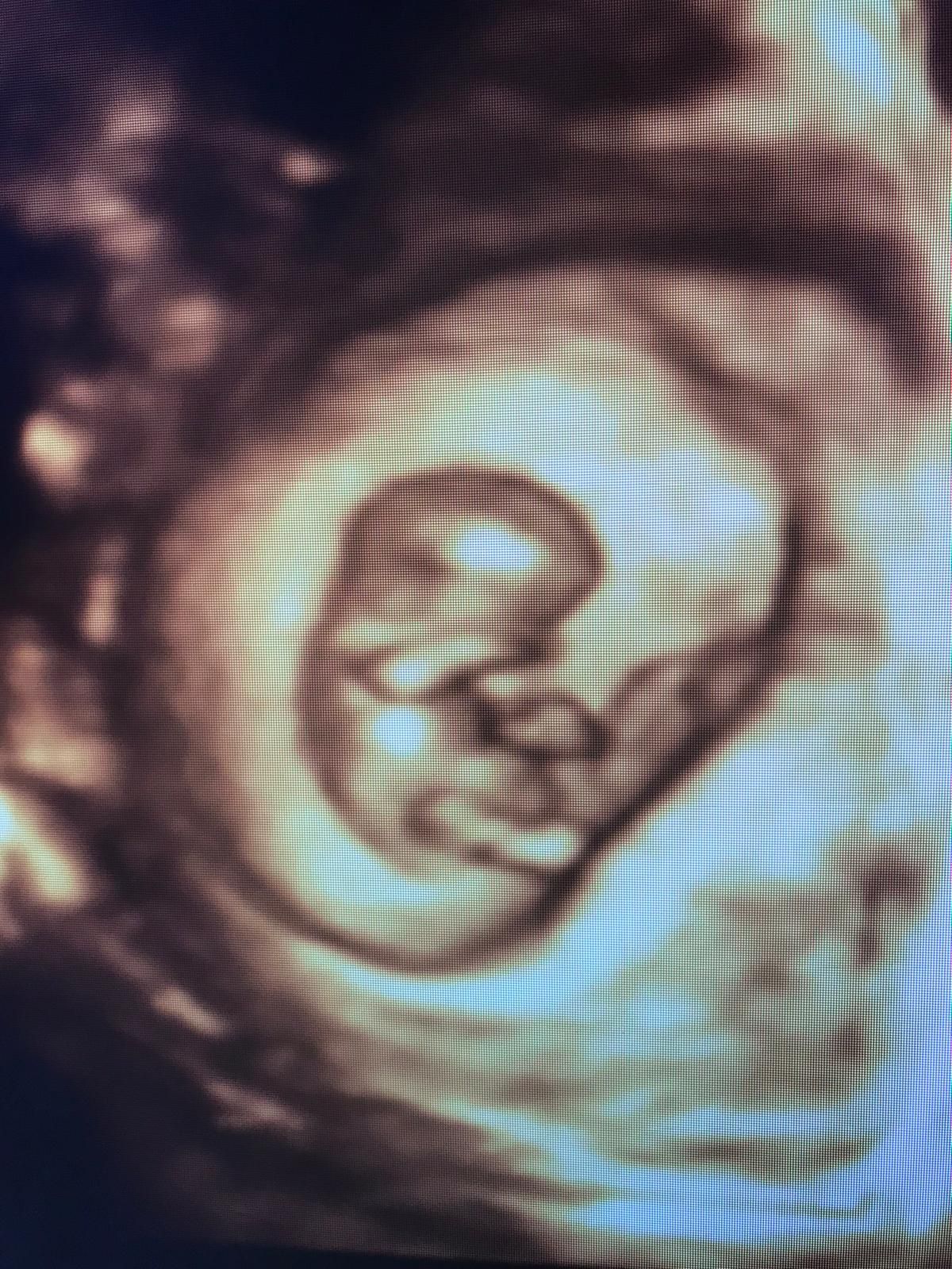 Özgü Keskin Yılmaz-6