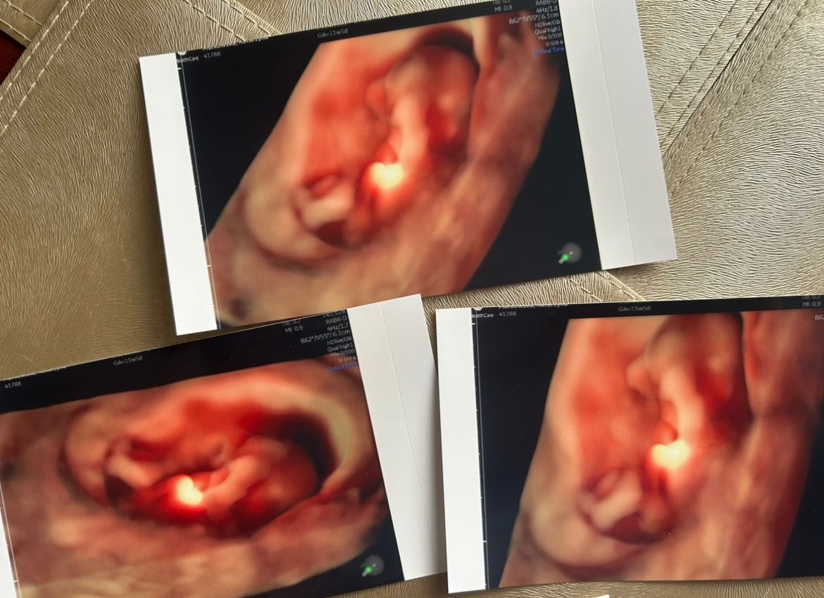 Wioletta Rozmus-Warcholińska-135