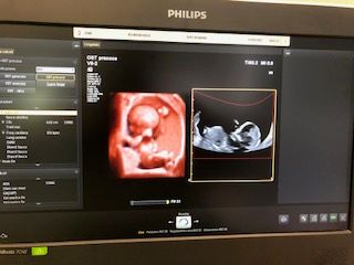 Domenico D'assisi-14